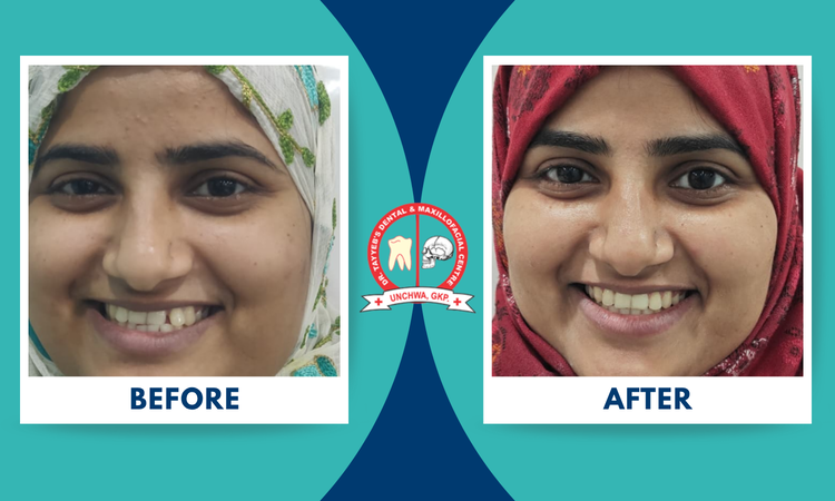 braces treatment at dr tayyeb's